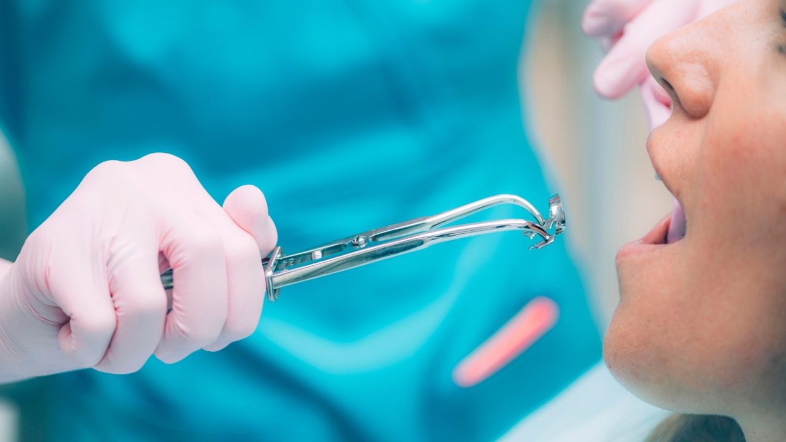 Endodoncja: Klucz do ratowania zębów przed ekstrakcją