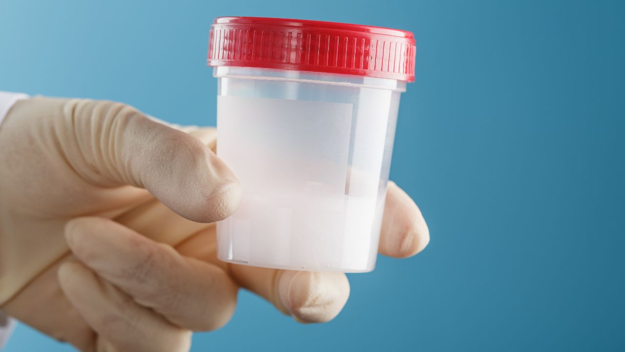 Jak terapia antybiotykiem może wpłynąć na wyniki badań nasienia?