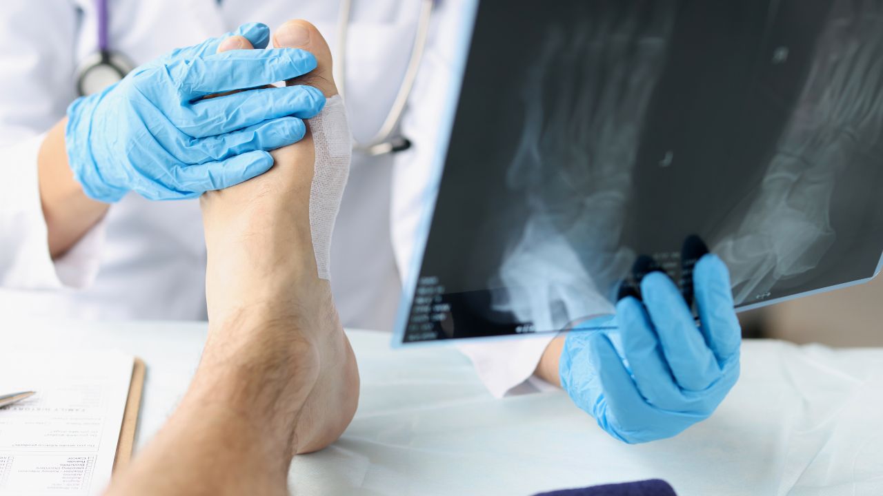 Jak badania komputerowe stóp mogą pomóc w diagnozowaniu i leczeniu różnych schorzeń?