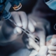 Neurochirurgia: Nowoczesne metody leczenia schorzeń układu nerwowego