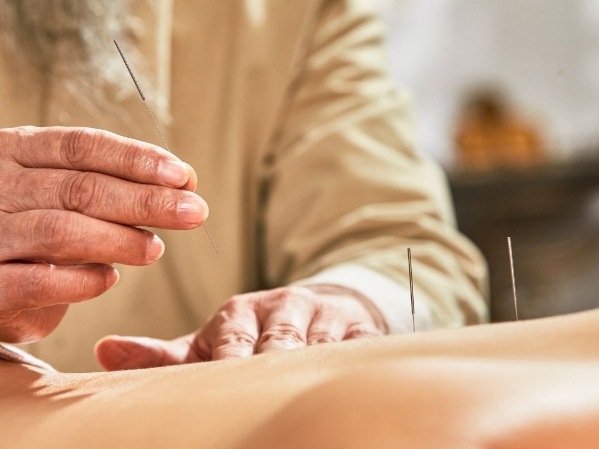 Na jakie schorzenia pomaga akupunktura