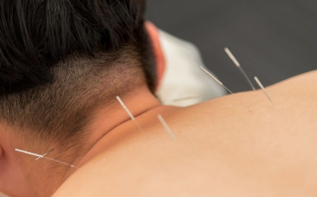 Na czym polega akupunktura i czy jest bezpieczna
