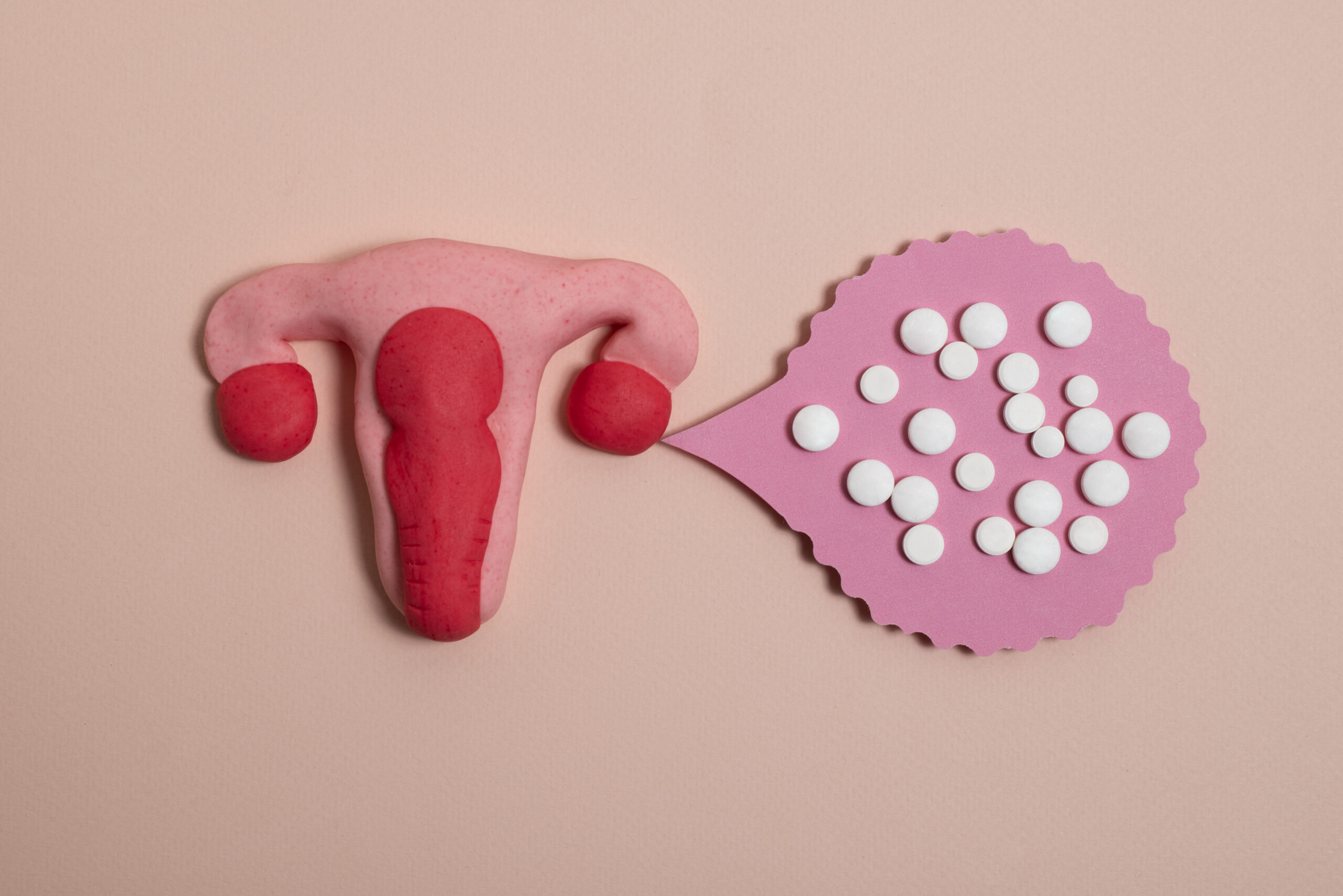 PCOS a problemy hormonalne - jak wygląda diagnostyka?