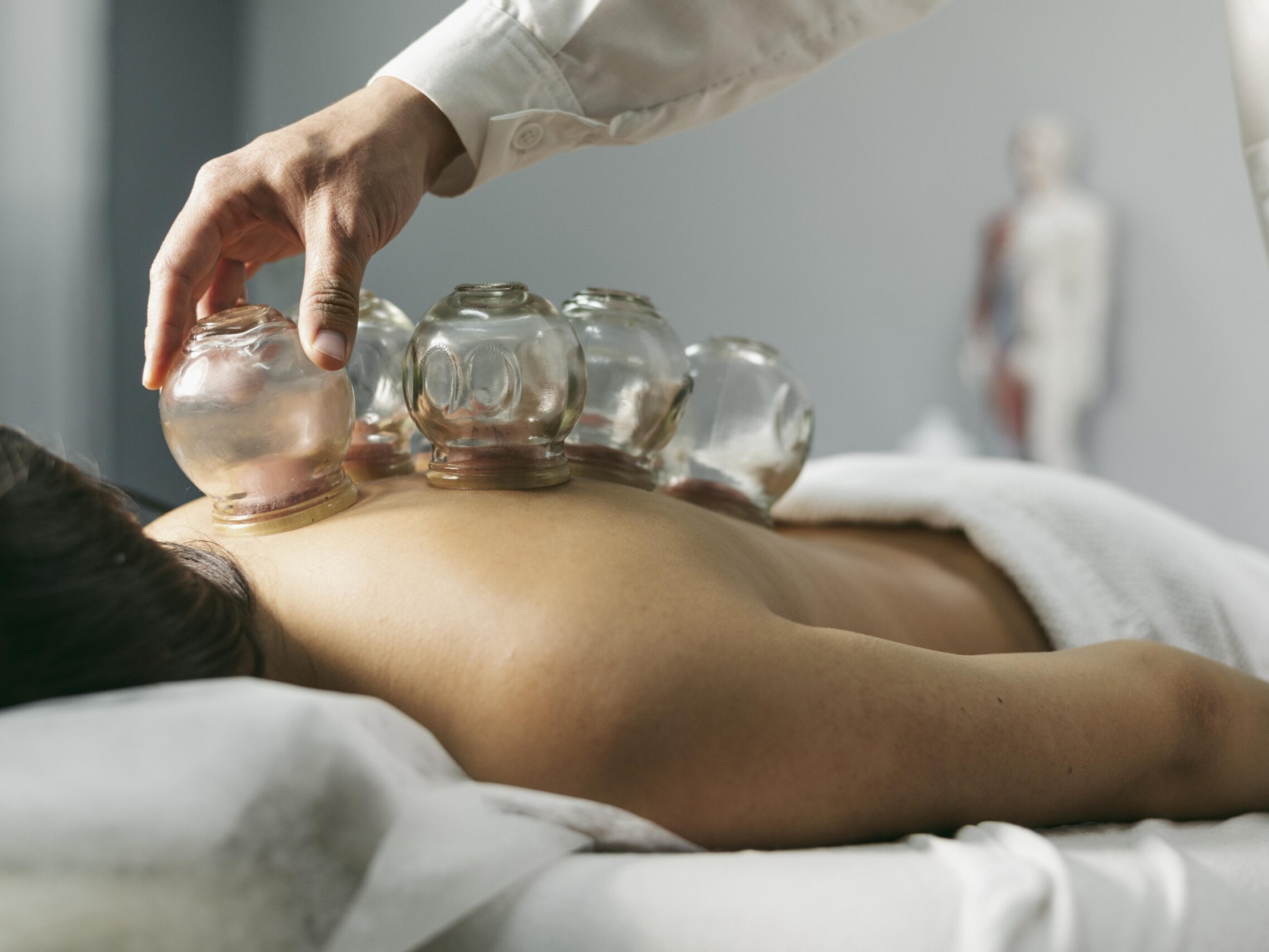 Terapia bańkami chińskimi: jak poprawić zdrowie i samopoczucie naturalnie