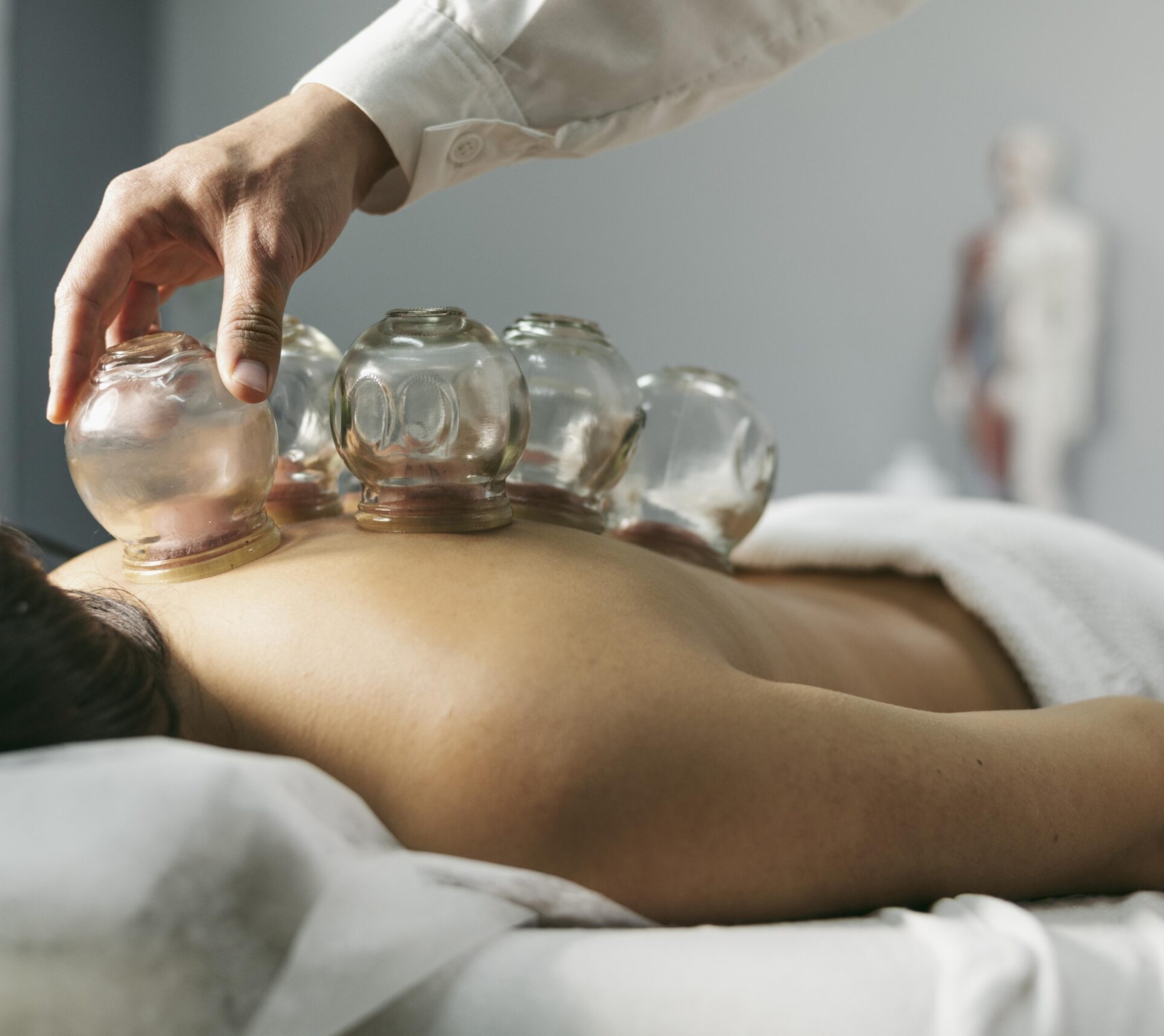 Terapia bańkami chińskimi: jak poprawić zdrowie i samopoczucie naturalnie