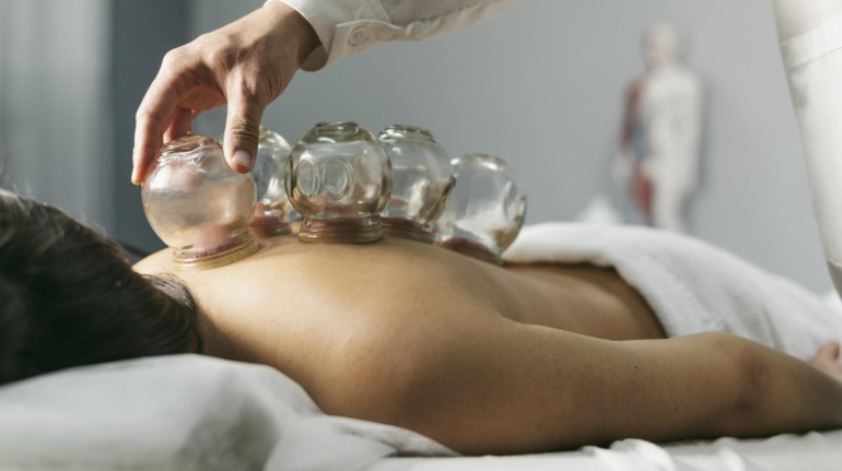 Terapia bańkami chińskimi: jak poprawić zdrowie i samopoczucie naturalnie
