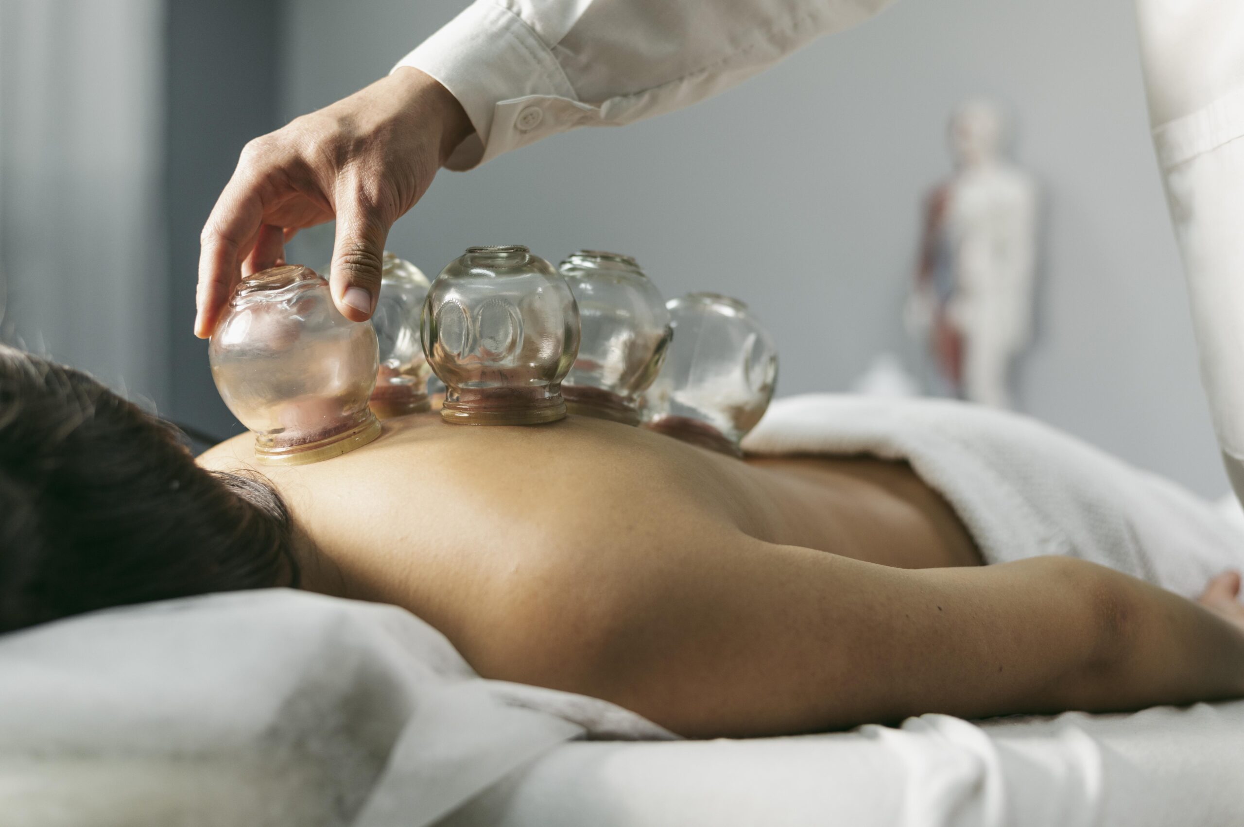 Terapia bańkami chińskimi: jak poprawić zdrowie i samopoczucie naturalnie